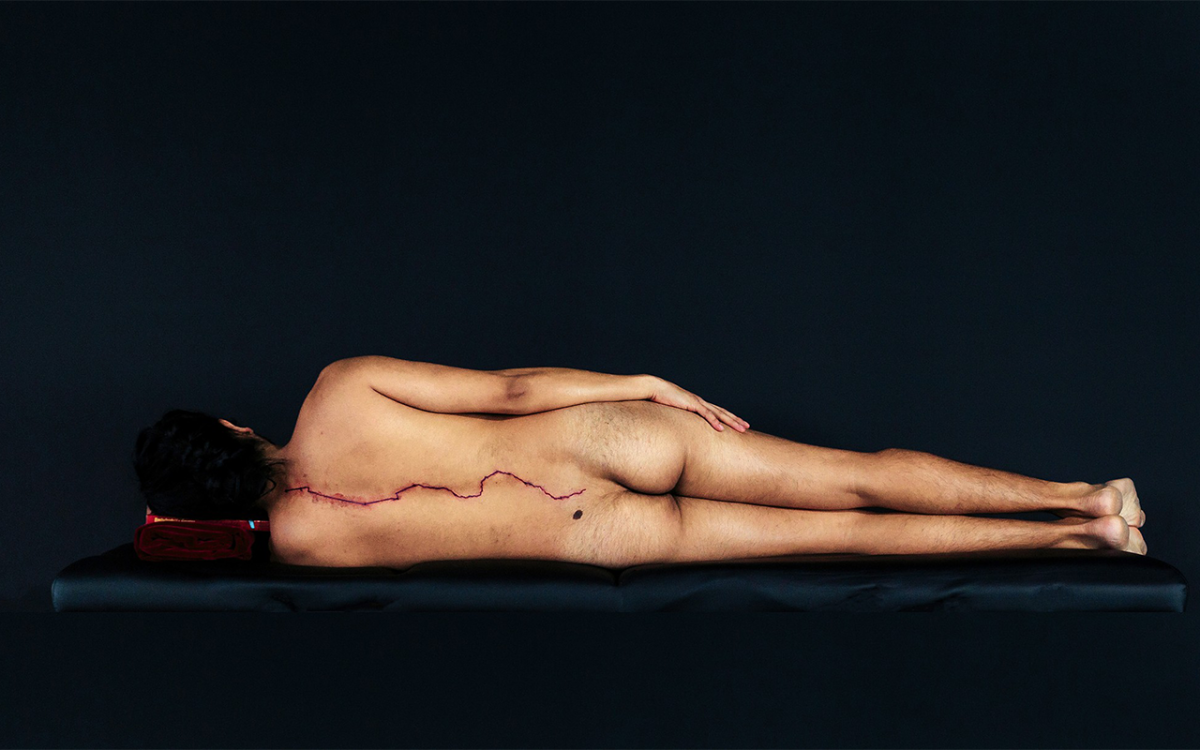 man laying on his side with back to the camera revealing a bleeding wound running down his spine